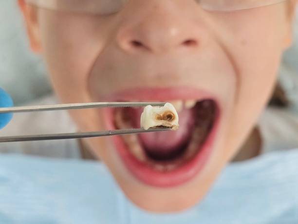 Best Emergency Dentist Open Today  in Heyworth, IL